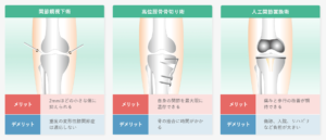 膝　手術の種類